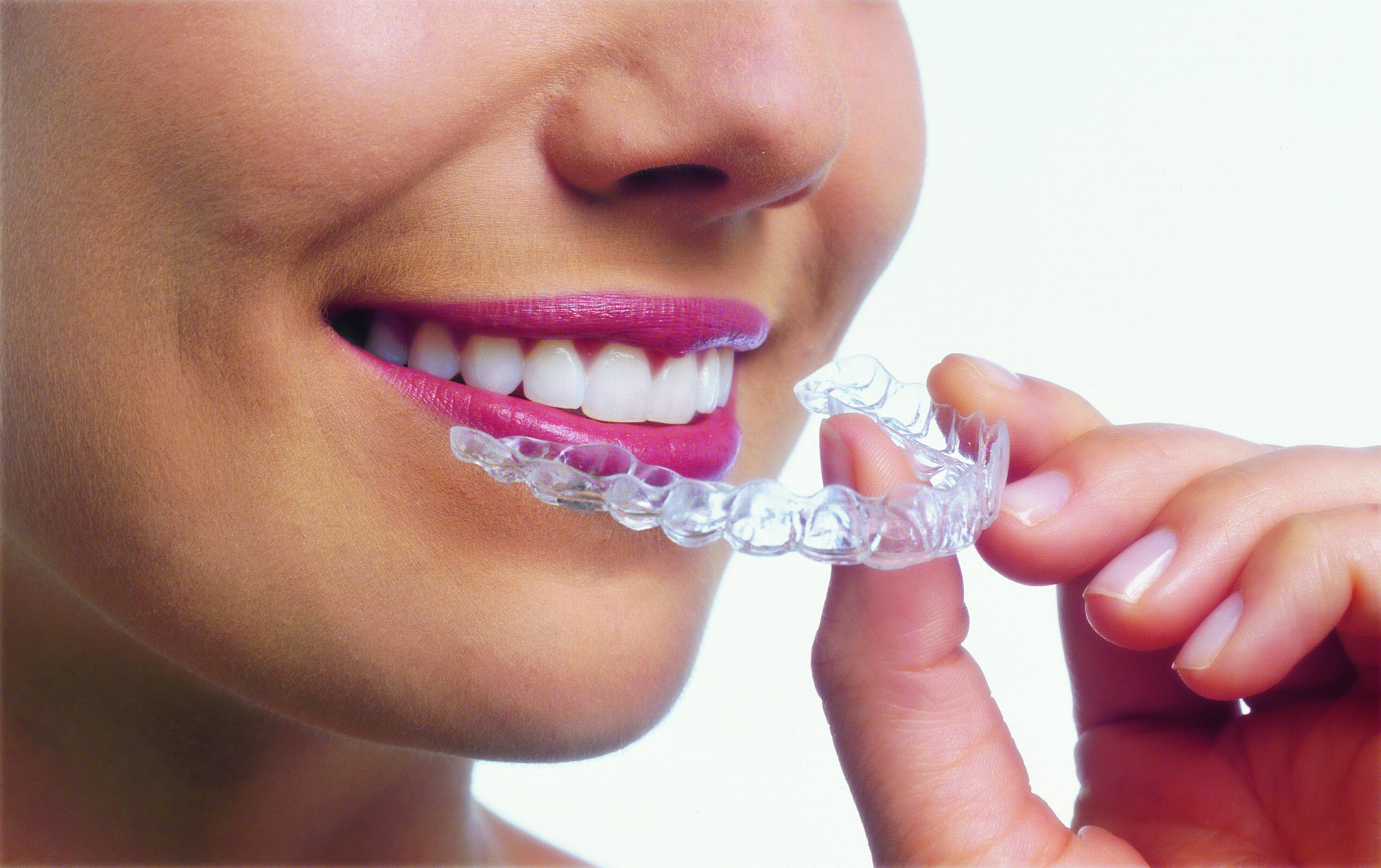 Invisalign retainer close up