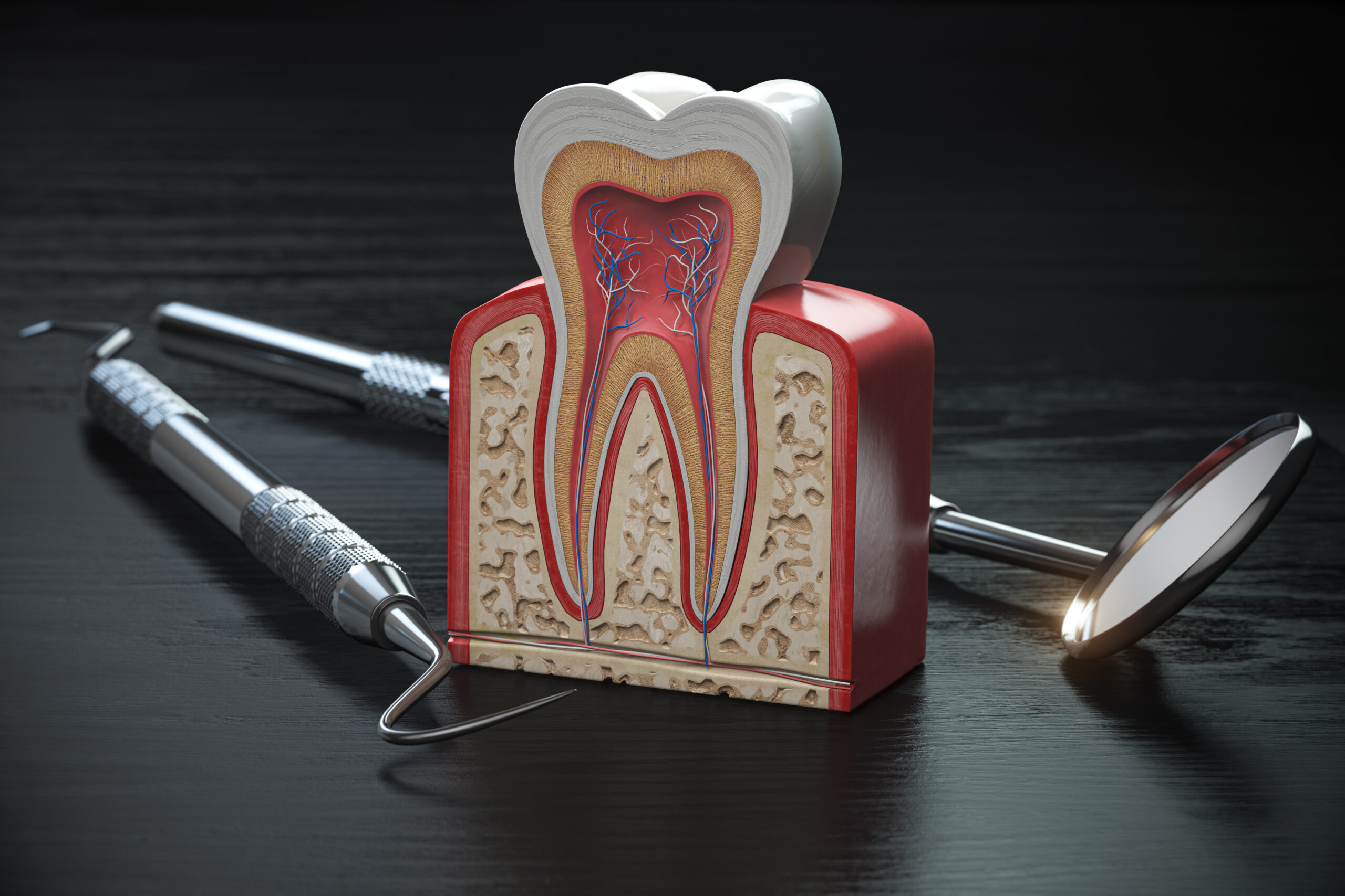Root Canal Therapy